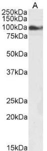 Anti-TRPC6 Antibody (A84123) (1µg/ml) staining of A549 cell lysate (35µg protein in RIPA buffer). Detected by chemiluminescence.