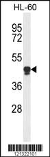 Anti-PLA2G7 Rabbit Polyclonal Antibody