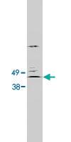 Anti-CERS2 Rabbit Polyclonal Antibody