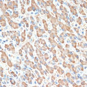 Immunohistochemistry analysis of paraffin-embedded human liver using Anti-PON1 Antibody [ARC2001] (A308894) at a dilution of 1:100 (40x lens). Perform microwave antigen retrieval with 10 mM Tris/EDTA buffer pH 9.0 before commencing with IHC staining protocol