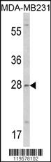 Anti-COLEC11 Rabbit Polyclonal Antibody