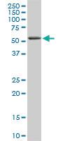 Anti-RIPK2 Mouse Monoclonal Antibody [clone: 6F7]