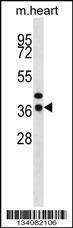 Anti-CEBPE Rabbit Polyclonal Antibody (FITC (Fluorescein Isothiocyanate))