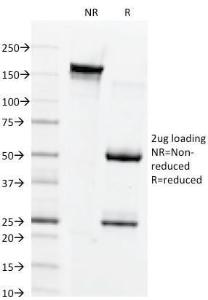 SDS-PAGE analysis of Anti-Connexin 32 Antibody [M12.13] under non-reduced and reduced conditions; showing intact IgG and intact heavy and light chains, respectively. SDS-PAGE analysis confirms the integrity and purity of the antibody