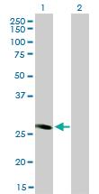 Anti-FHL5 Mouse Monoclonal Antibody [clone: 1G12-D2]