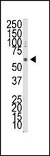 Anti-BMPR1A Rabbit Polyclonal Antibody