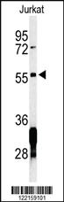 Anti-RNF8 Rabbit Polyclonal Antibody