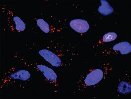 Anti-BID + FASLG Antibody Pair