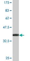 Anti-NR1D1 Mouse Monoclonal Antibody [clone: 2G6]