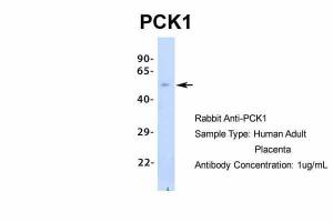 Anti-PCK1 Rabbit Polyclonal Antibody