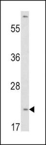 Anti-VHL Rabbit Polyclonal Antibody (AP (Alkaline Phosphatase))