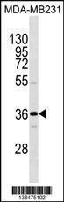 Anti-OR1I1 Rabbit Polyclonal Antibody (AP (Alkaline Phosphatase))