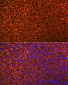 Immunofluorescence analysis of rat liver using Anti-PON1 Antibody [ARC2001] (A308894) at a dilution of 1:100 (40x lens). DAPI was used to stain the cell nuclei (blue)