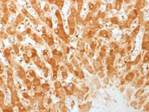 Immunohistochemical analysis of formalin-fixed, paraffin-embedded human liver using Anti-Connexin 32 Antibody [GJB1/1753]