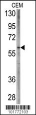 Anti-BMPR1A Rabbit Polyclonal Antibody