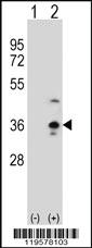 Anti-COLEC11 Rabbit Polyclonal Antibody