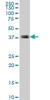 Anti-LEF1 Mouse Monoclonal Antibody [clone: 1H2]