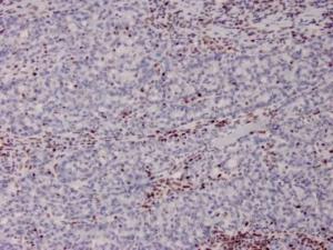 Anti-MSH2 Mouse Monoclonal Antibody [clone: MSH2/2622]