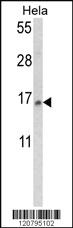 Anti-SPDL1 Rabbit Polyclonal Antibody