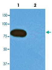 Anti-HHV8GK18_gp81 Mouse Monoclonal Antibody [clone: AT4C11]