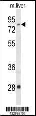 Anti-ACSS2 Rabbit Polyclonal Antibody (HRP (Horseradish Peroxidase))