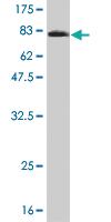 Anti-NT5C2 Mouse Monoclonal Antibody [clone: 3C1]