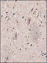 Anti-BMPR1A Rabbit Polyclonal Antibody