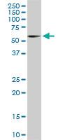 Anti-RIPK2 Mouse Monoclonal Antibody [clone: 6F7]