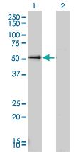 Anti-LEF1 Mouse Monoclonal Antibody [clone: 1H2]