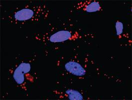 Anti-WEE1 + FBXW11 Antibody Pair