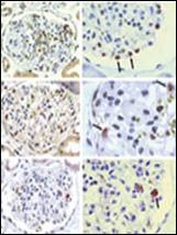 Anti-BMPR1A Rabbit Polyclonal Antibody