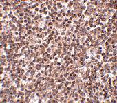 Anti-TREX1 Rabbit Polyclonal Antibody