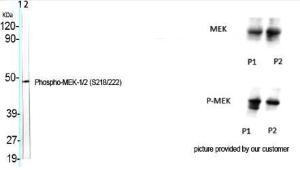 Western blot analysis of various cells using Anti-MEK1 + MEK2 (phospho Ser217) Antibody