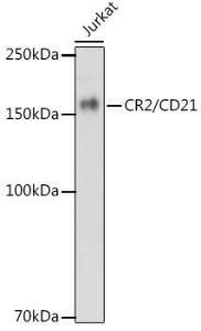 Anti-CD21 antibody