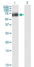 Anti-RIPK2 Mouse Monoclonal Antibody [clone: 6F7]