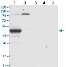 Anti-EPHX4 Rabbit Polyclonal Antibody