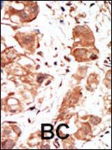 Anti-PIM1 Rabbit Polyclonal Antibody