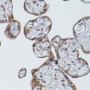 Immunohistochemistry analysis of paraffin-embedded human placenta using Anti-CD147 Antibody (A11460) at a dilution of 1:100 (40X lens). Perform high pressure antigen retrieval with 10 mM citrate buffer pH 6.0 before commencing with IHC staining protocol