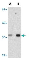 Anti-TREX1 Rabbit Polyclonal Antibody