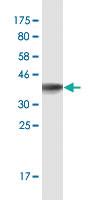 Anti-NR1D1 Mouse Monoclonal Antibody [clone: 4C2]