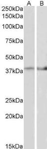 Anti-IDH3B Antibody (A82627) (2 µg/ml) staining of Mouse Heart (A) and Mouse Muscle (B) lysate (35 µg protein in RIPA buffer) Primary incubation was 1 hour Detected by chemiluminescence