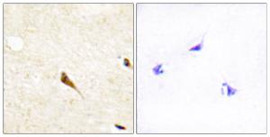 Immunohistochemical analysis of paraffin-embedded human brain tissue using Anti-MOK Antibody. The right hand panel represents a negative control, where the antibody was pre-incubated with the immunising peptide