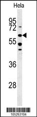 Anti-BMPR1A Rabbit Polyclonal Antibody