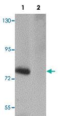 Anti-SESTD1 Rabbit Polyclonal Antibody