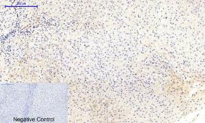 Immunohistochemical analysis of paraffin-embedded human liver tissue using Anti-MEK1 + MEK2 (phospho Ser217) Antibody at 1:200 (4°C overnight). Negative control was secondary antibody only.