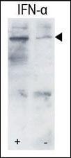 Anti-STAT3 Rabbit Polyclonal Antibody