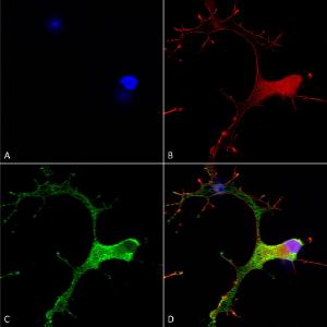 Immunocytochemistry/Immunofluorescence analysis of human neuroblastoma cells (SH-SY5Y), fixed in 4% PFA for 15 min, using Anti-GABA B Receptor 1 Antibody [S93A-49] (A304759), at 1:50 for overnight at 4°C with slow rocking