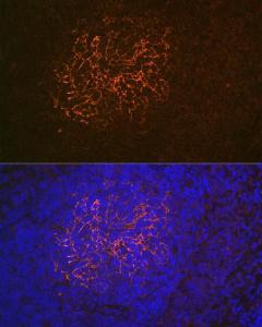 Anti-CD21 antibody