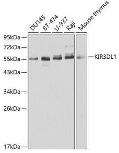 Western blot analysis of extracts of various cell lines, using Anti-KIR3DL1 Antibody (A1617) at 1:1000 dilution