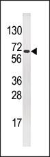 Anti-BMPR1A Rabbit Polyclonal Antibody